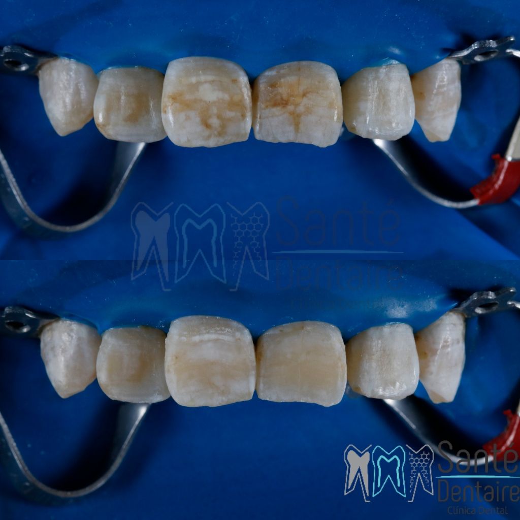 Daniel Oñate Robledo-32