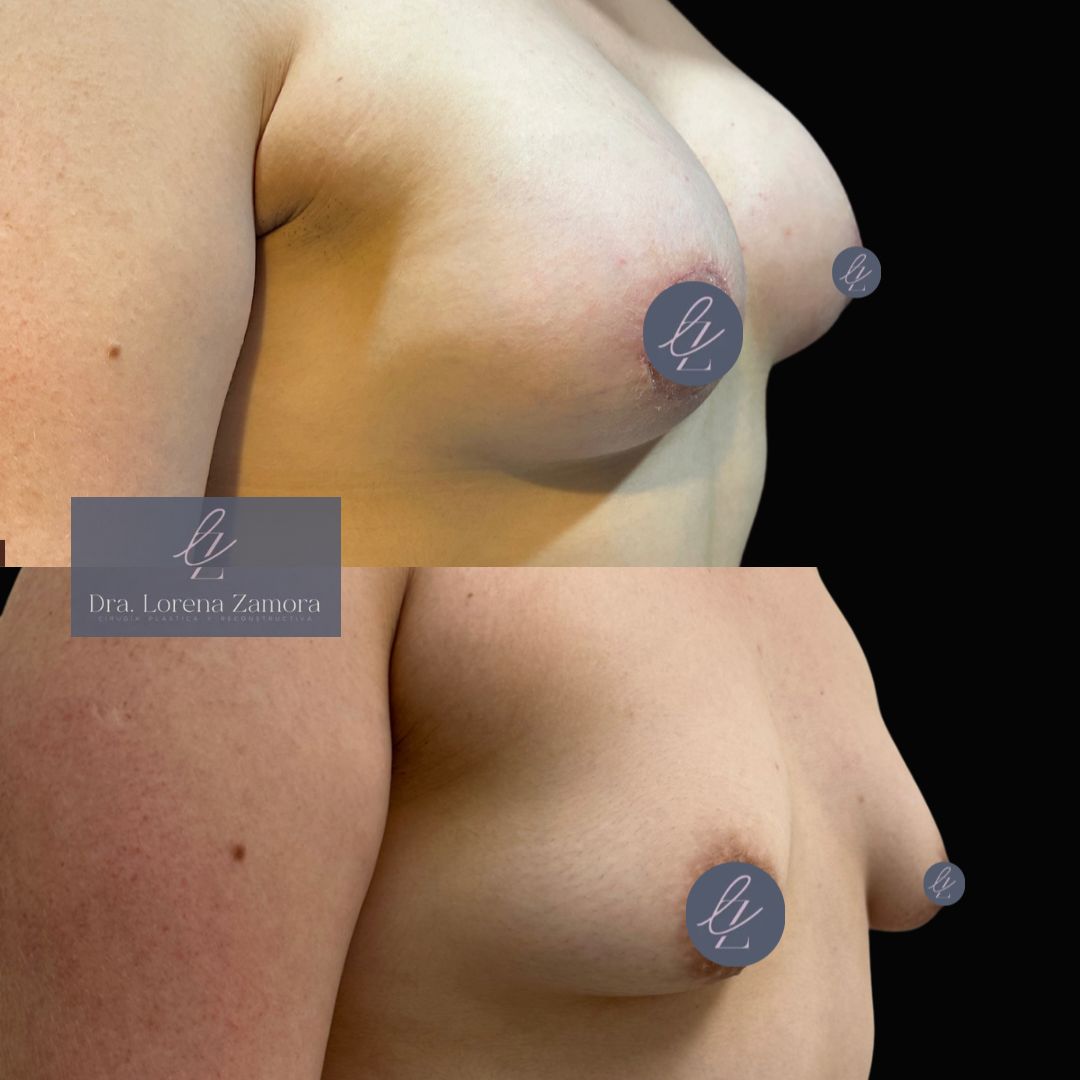 Lorena Zamora Pérez-4