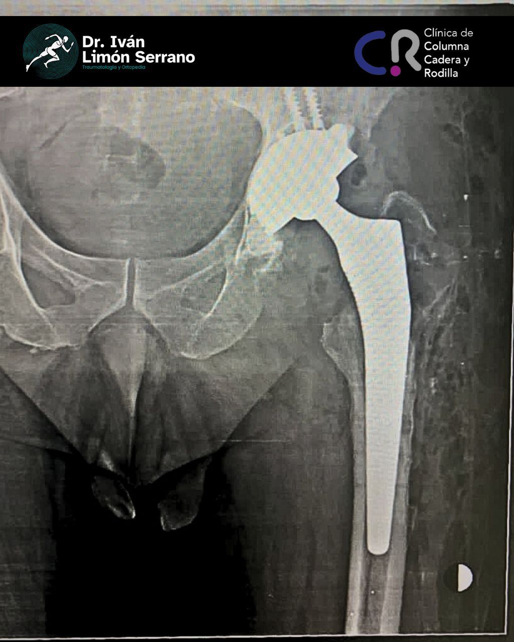 Iván Limón Serrano-36