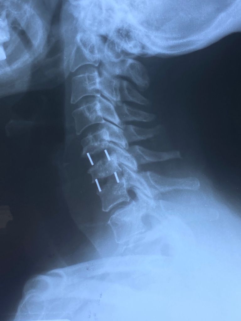 Rodolfo Pérez Ramos-3