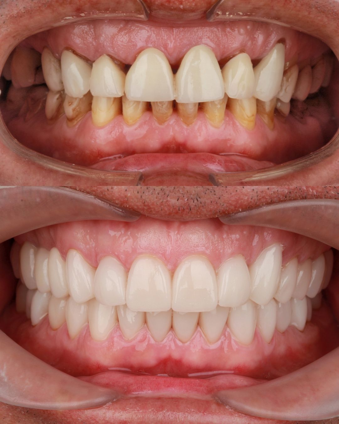 Diana Chacon Cervera-11