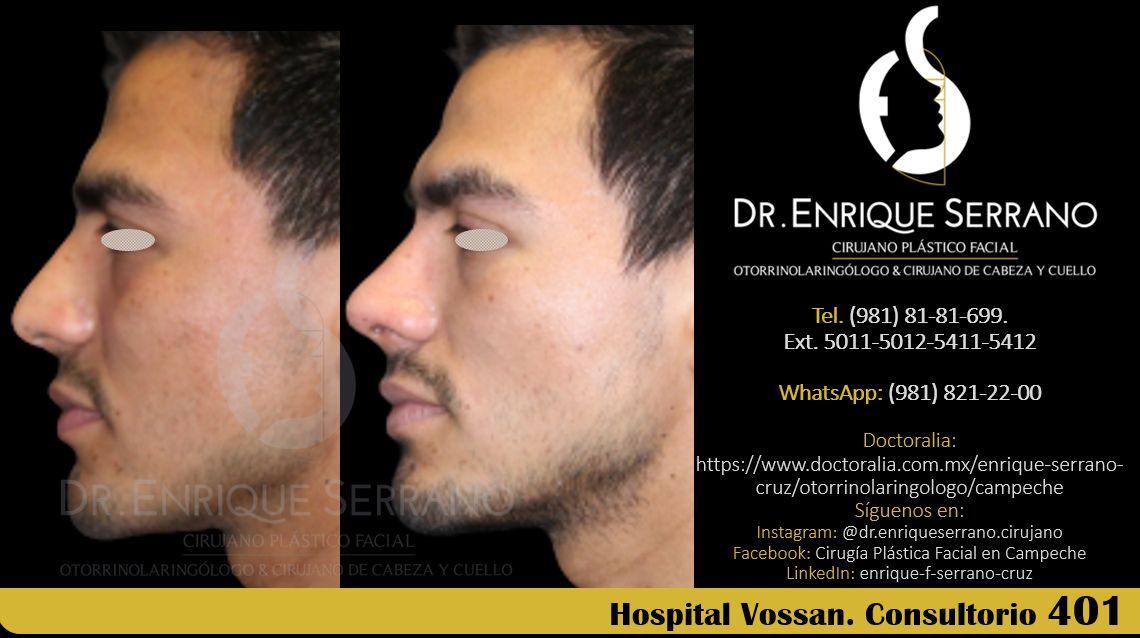 Enrique Serrano Cruz-99