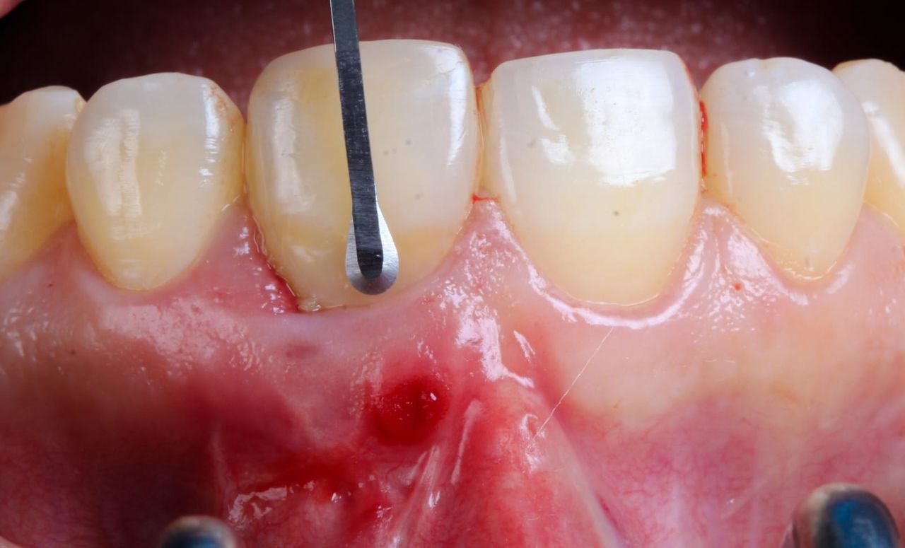 Hugo Enrique Aguilar Lamas-18