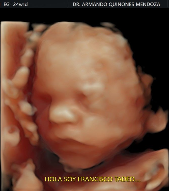 Armando Quiñones Mendoza-4