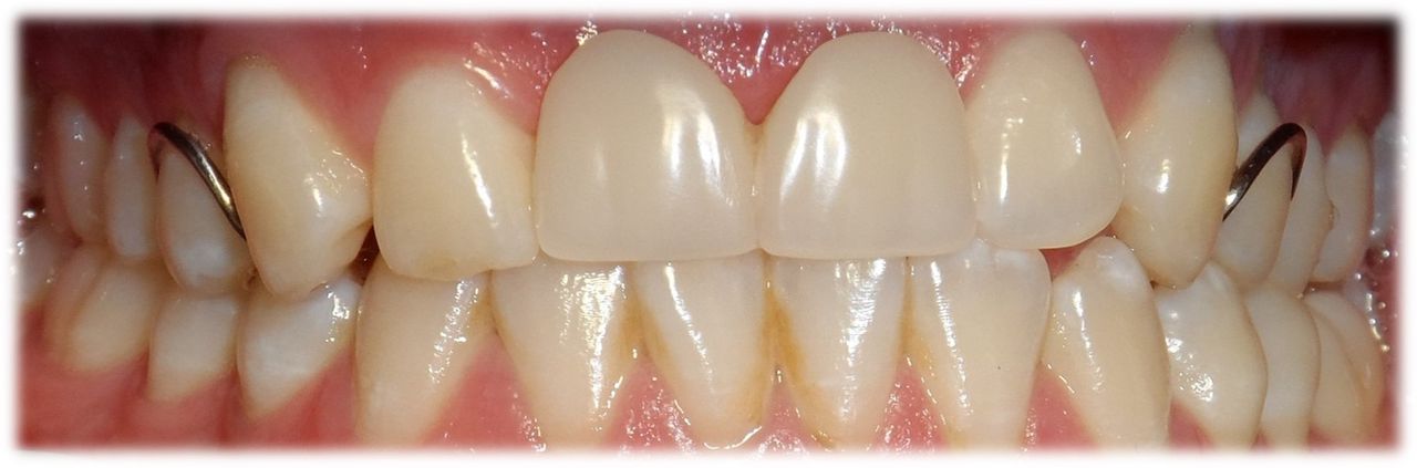 Juan Manuel Méndez Ferrusco-3