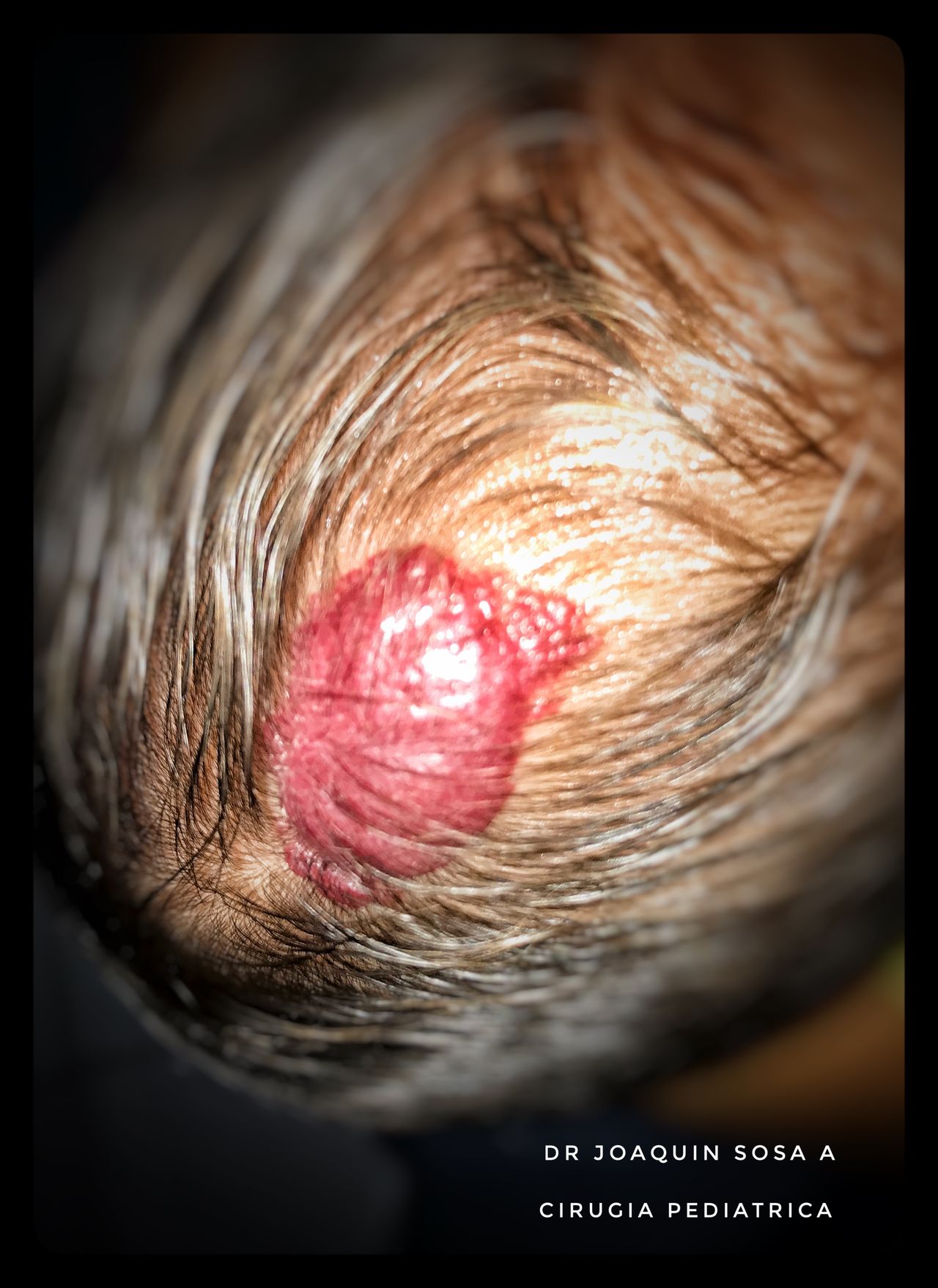 R. Joaquín Sosa Azcorra-23