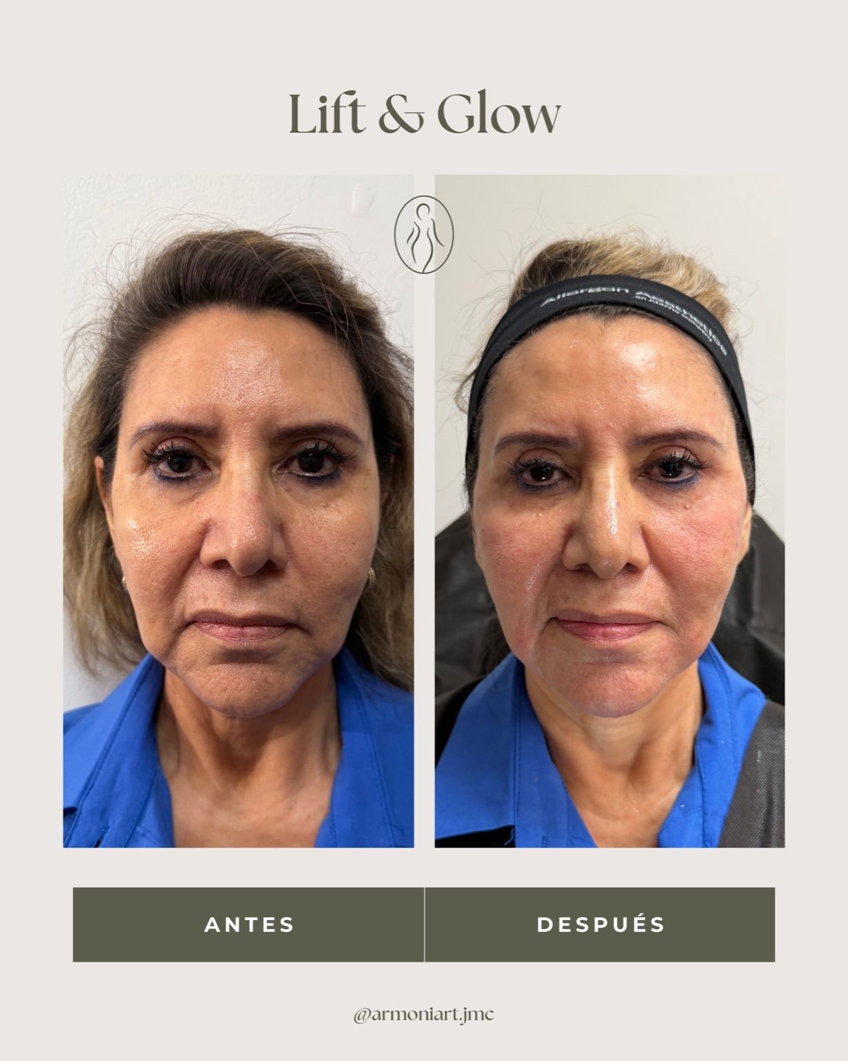 Josehlyn Martínez Carrillo-0