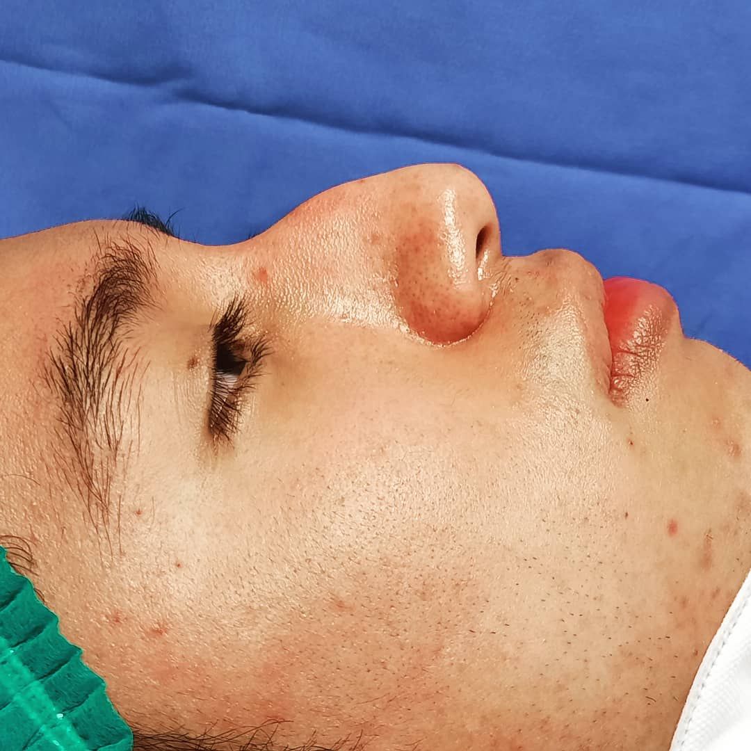 Juan Carlos Pérez Cancino-2