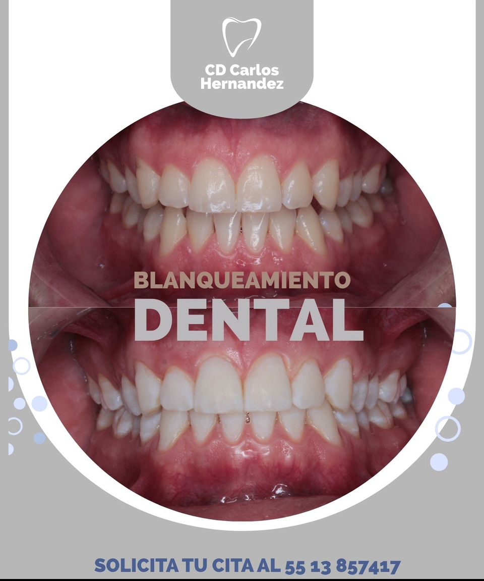 Carlos Enrique Hernández Rodríguez-30