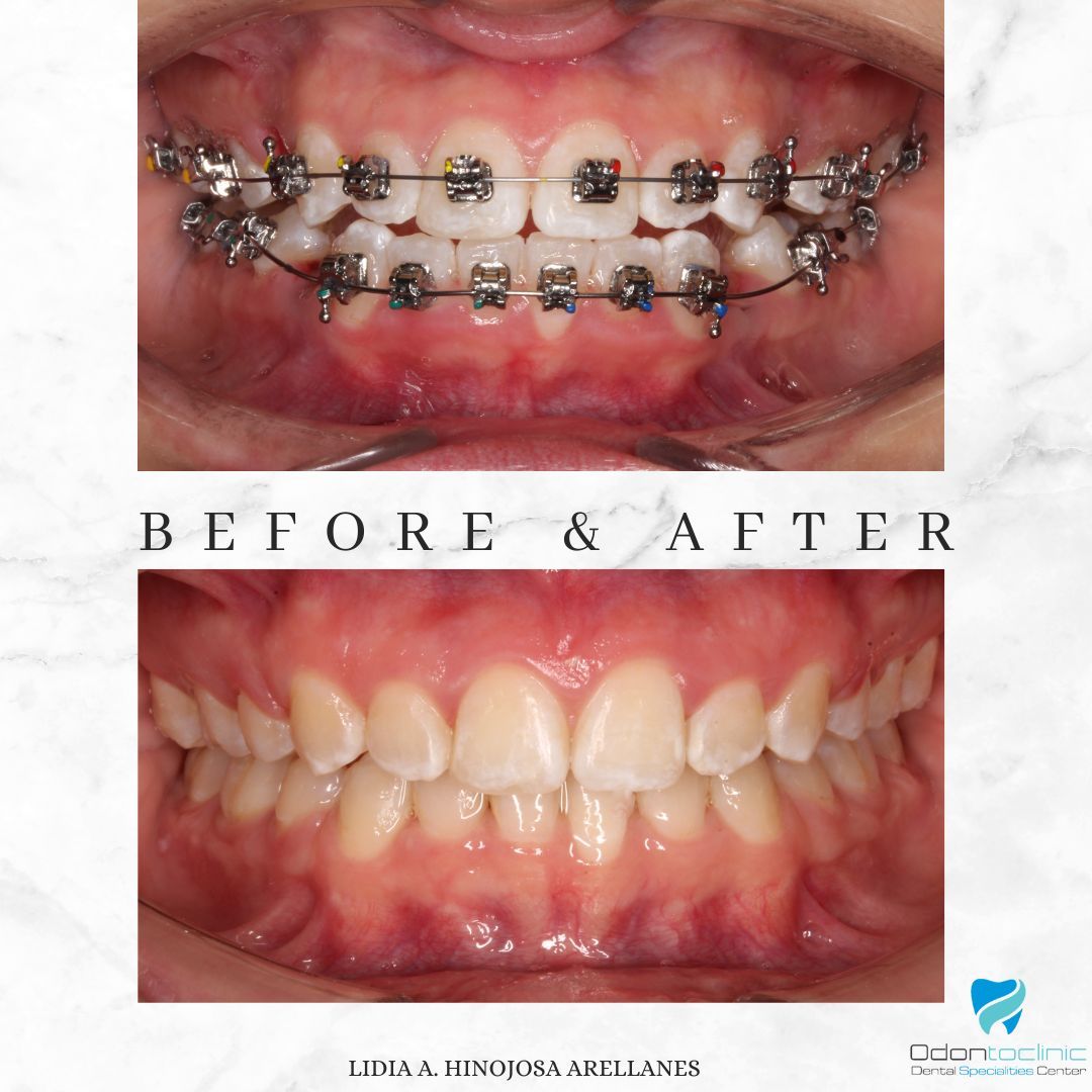 Lidia Abigail Hinojosa Arellanes-41