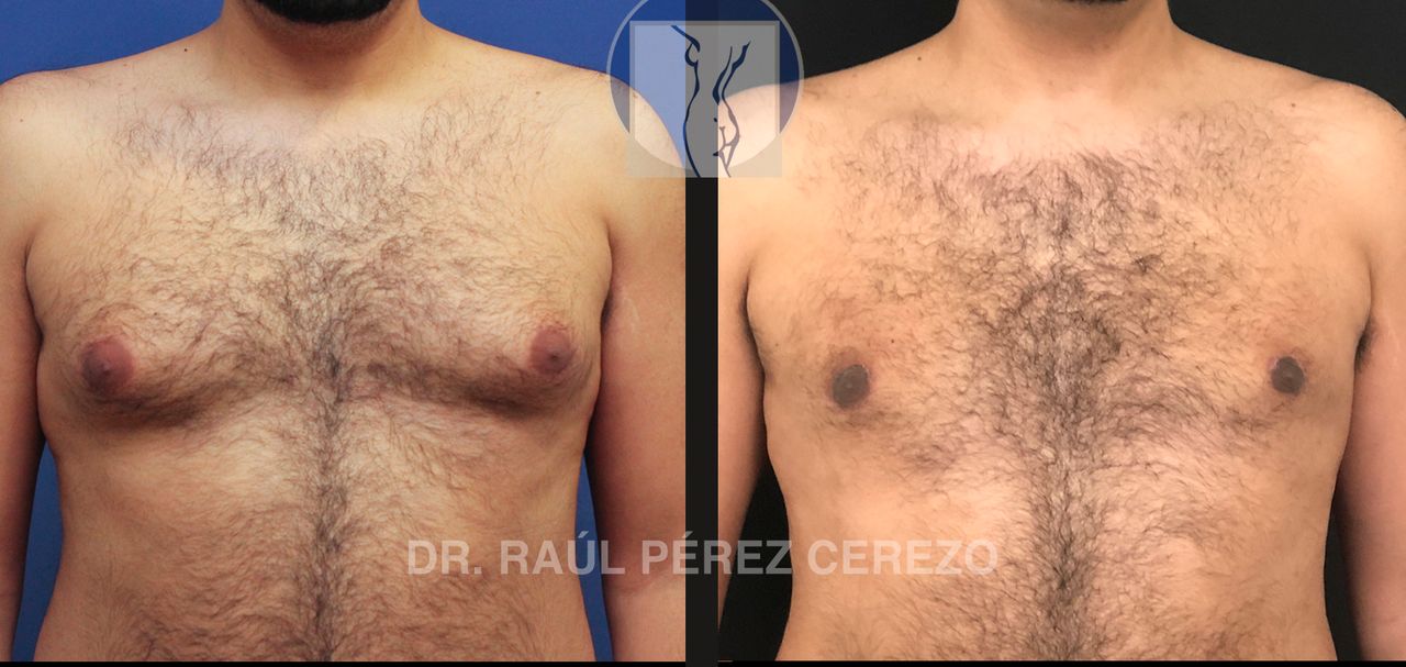 Raúl Pérez Cerezo-38