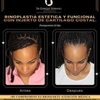 Enrique Serrano Cruz-4