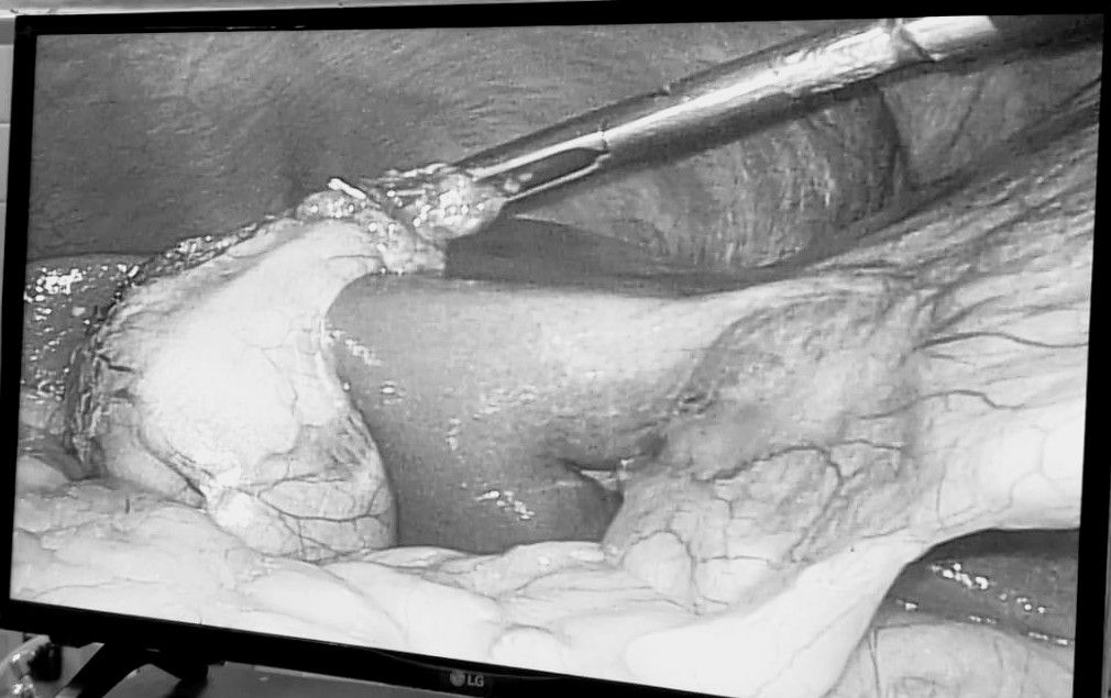 Iván Nájera Ayuso-44