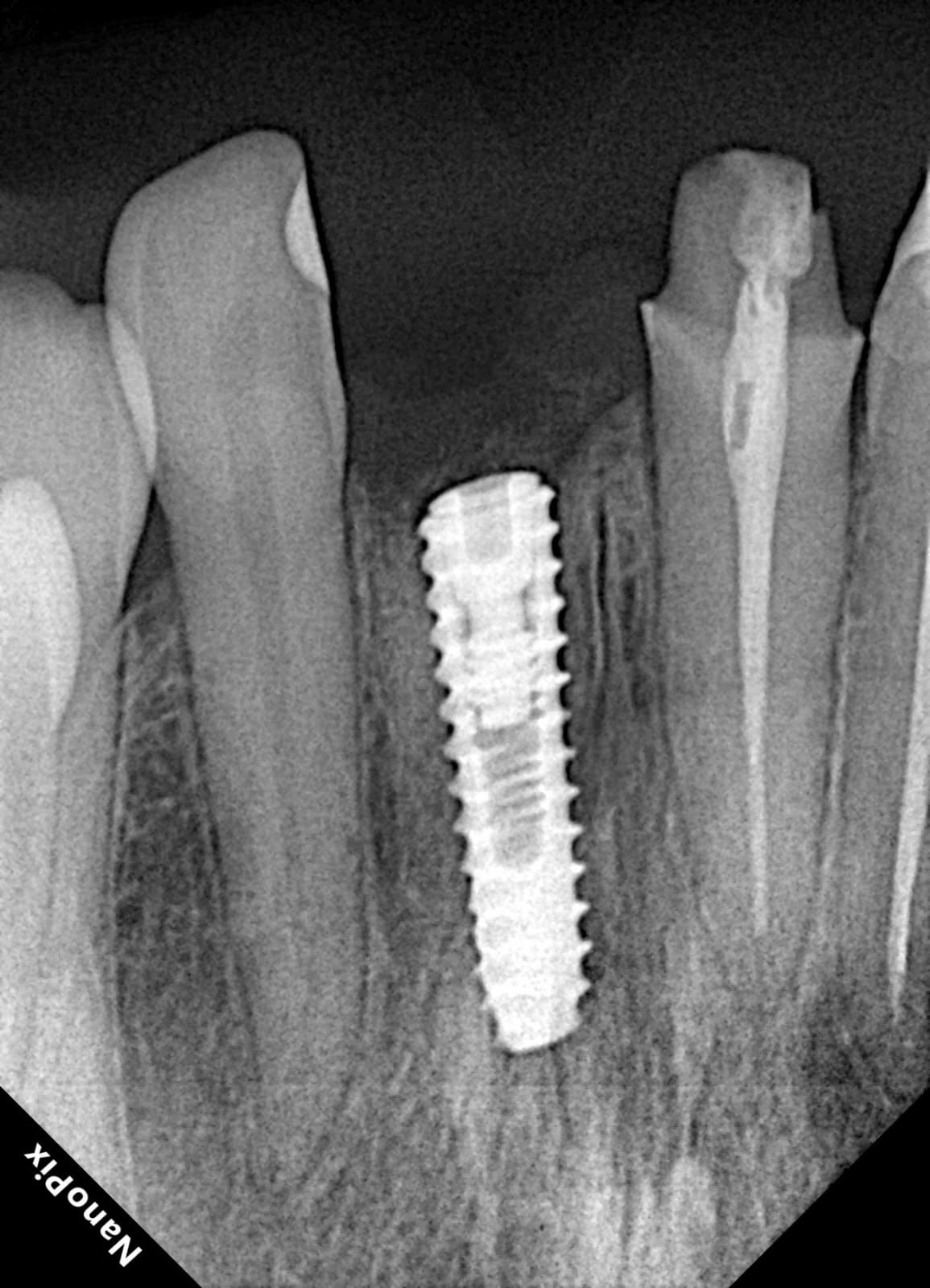 Sebastian Chaustre-6