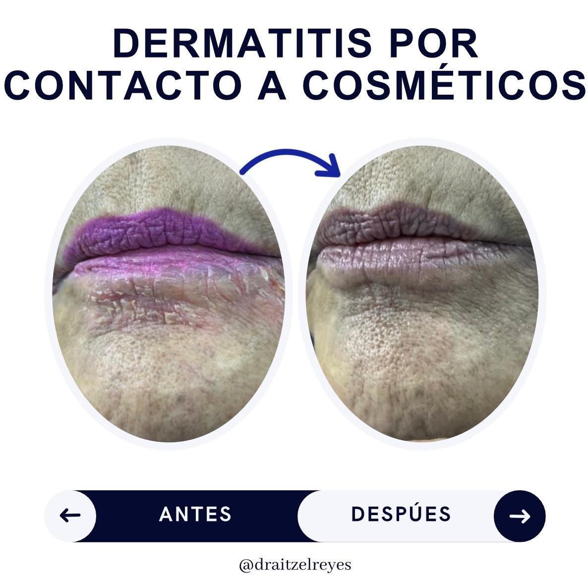 Itzel Anayn Flores Reyes-36