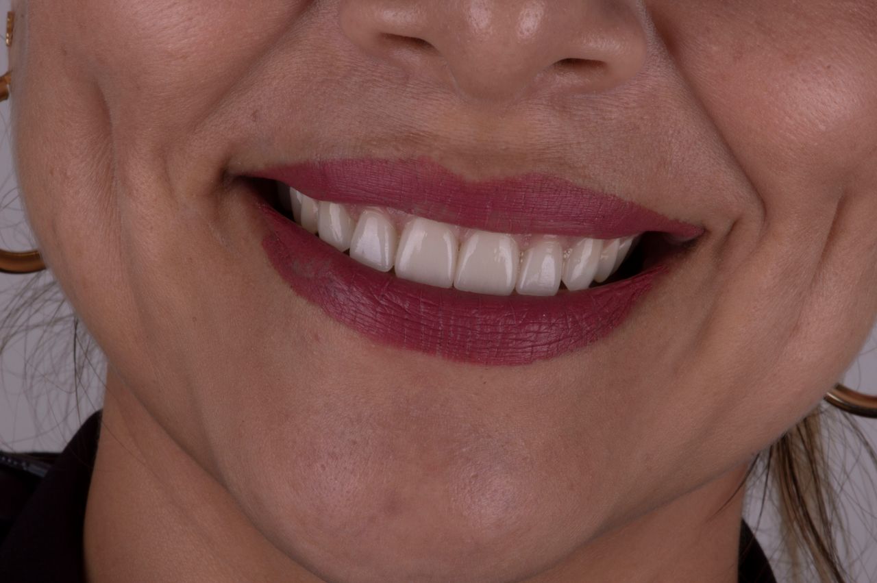 María Fernanda González Gastelum-5