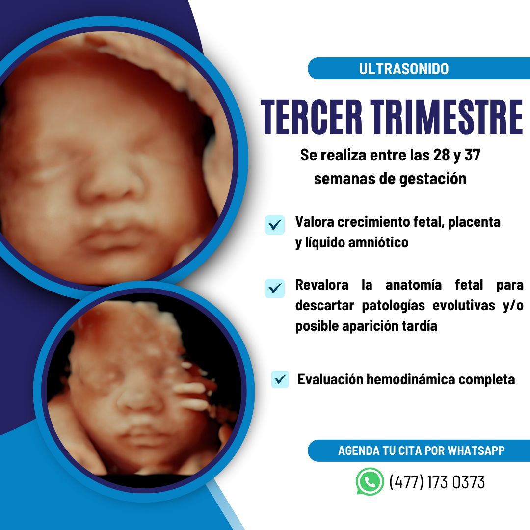 Fernando Nieto Landeros-3