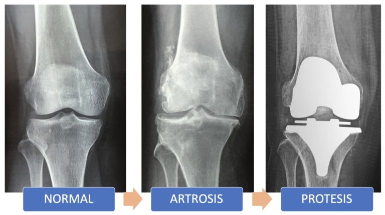 Gerardo Segundo Primero-6