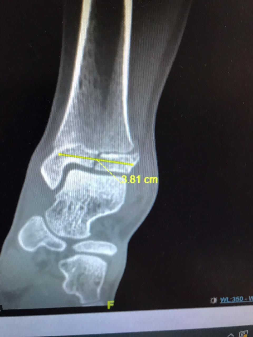 Victor Manuel Alayon Vazquez-4