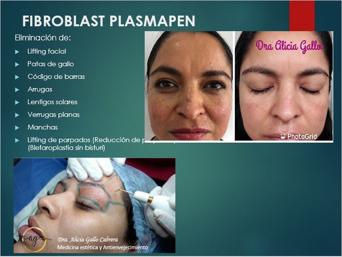 Alicia Gallo Cabrera-19