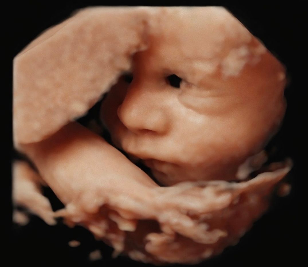 Sarai Esquivel Reyes-1