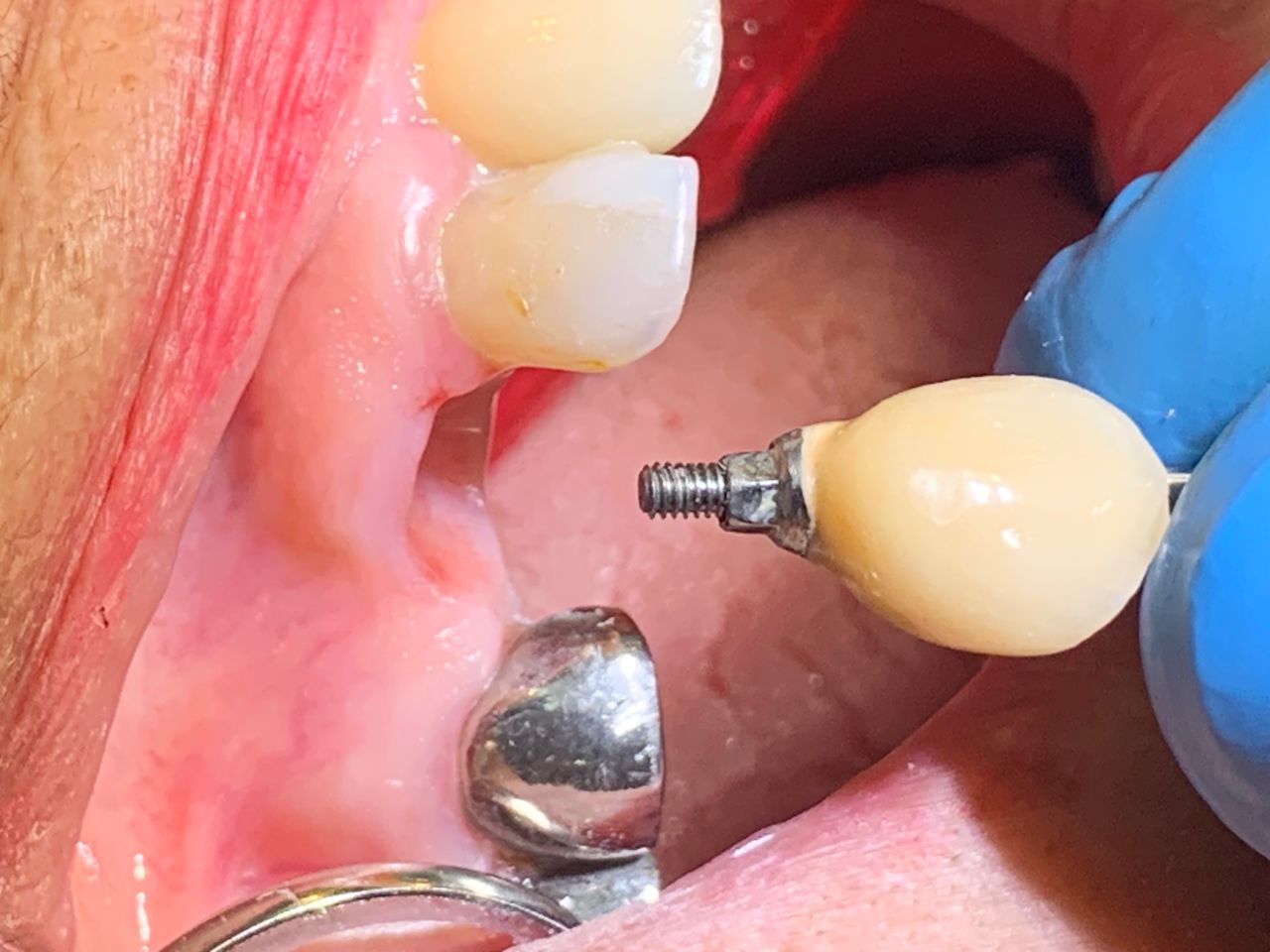 Alberto Miguel Rodriguez Soto-42