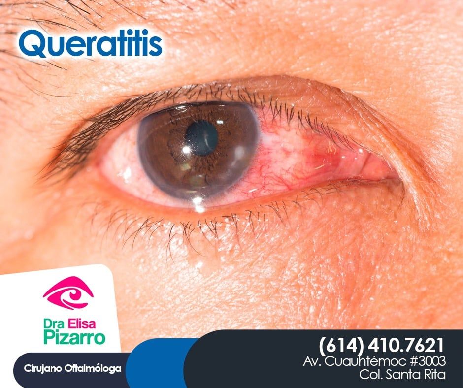 María Elisa Pizarro Barrera-2