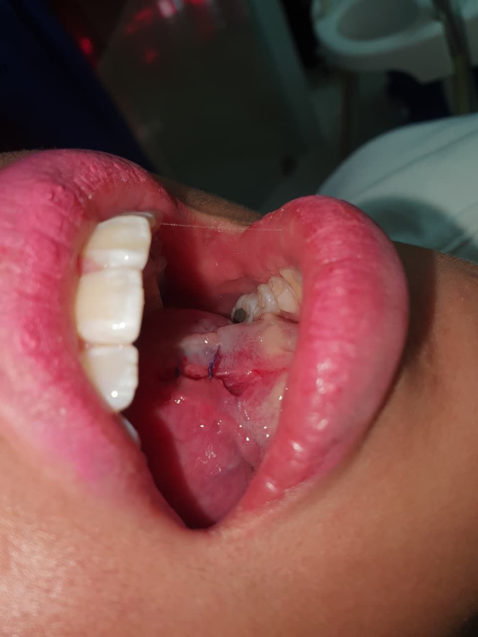 Fernando Olivier Victoriano-4