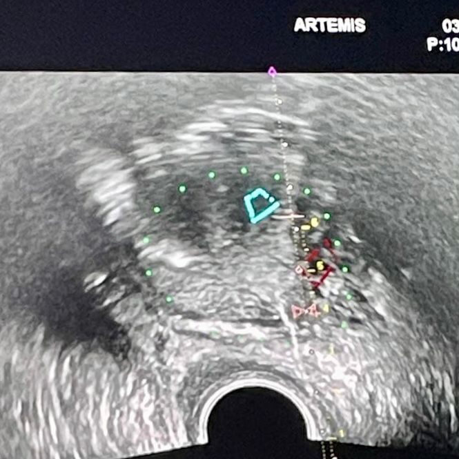 Víctor Ríos Dávila-26