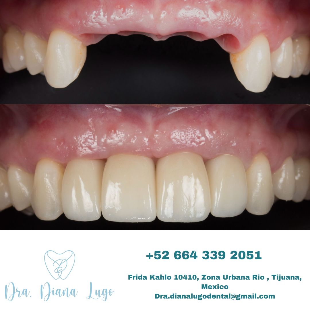 Diana Paola Lugo Bojorquez-16