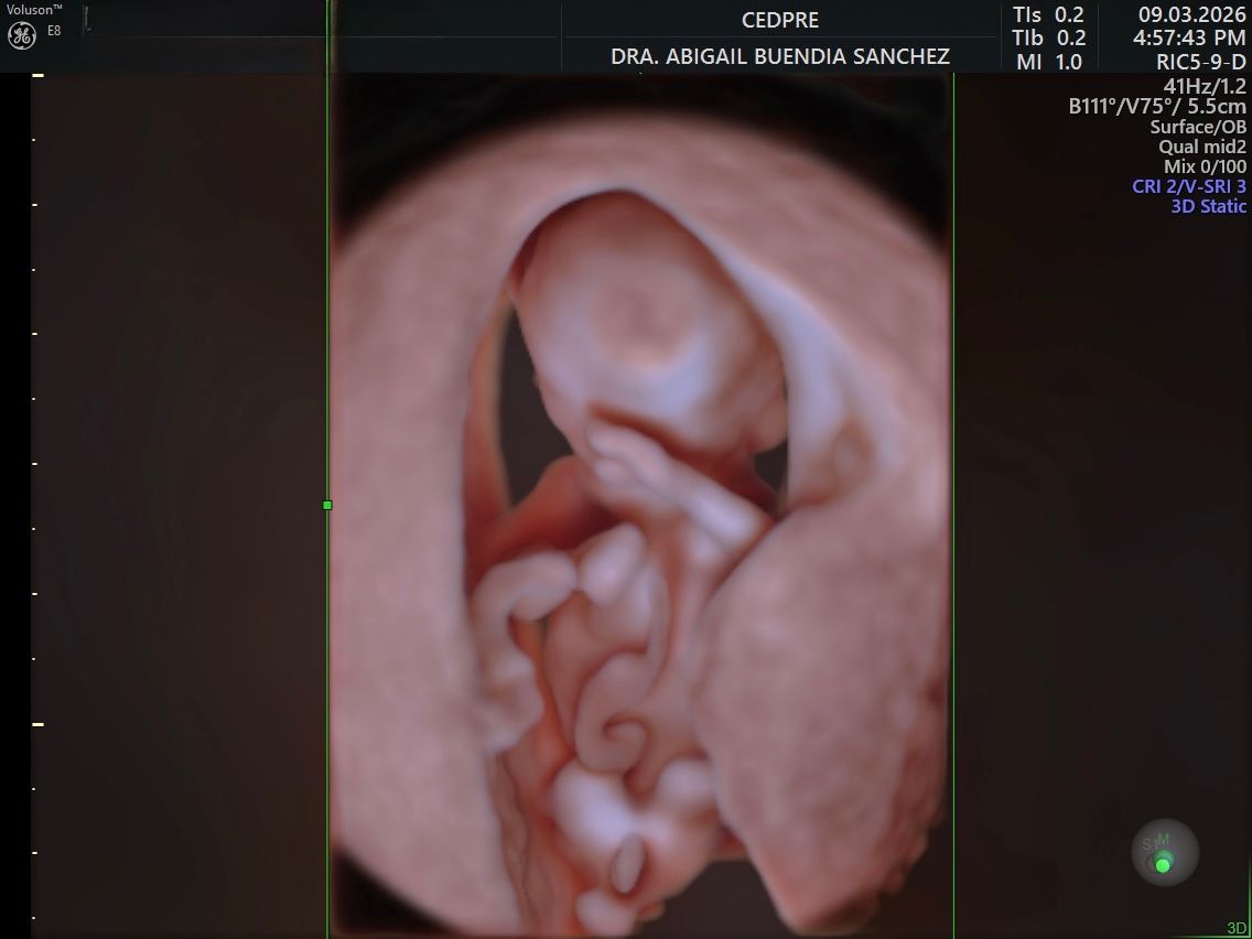 Abigail Buendia Sanchez-2