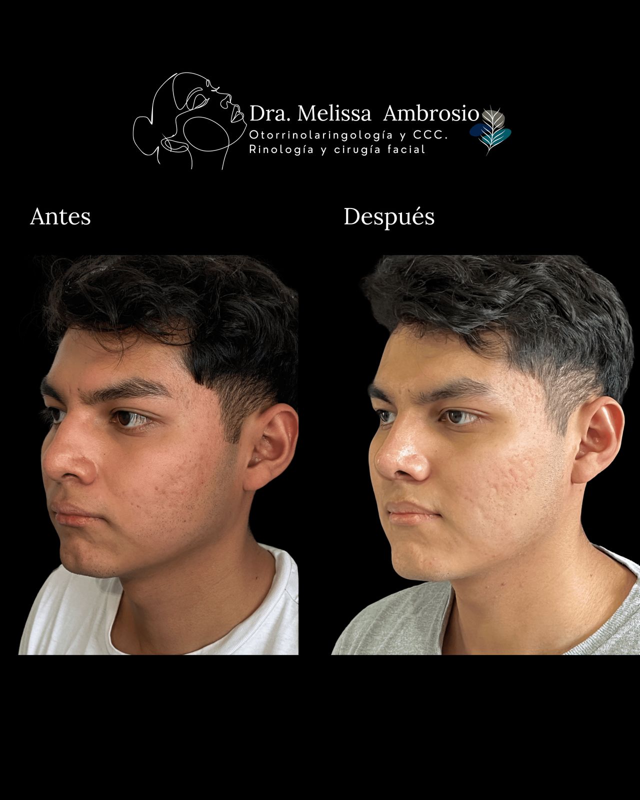 Melissa Guadalupe Ambrosio Mendoza-4