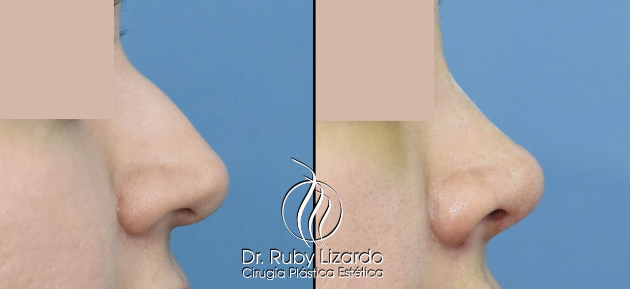 Ruby Lizardo Ramírez Robles-6