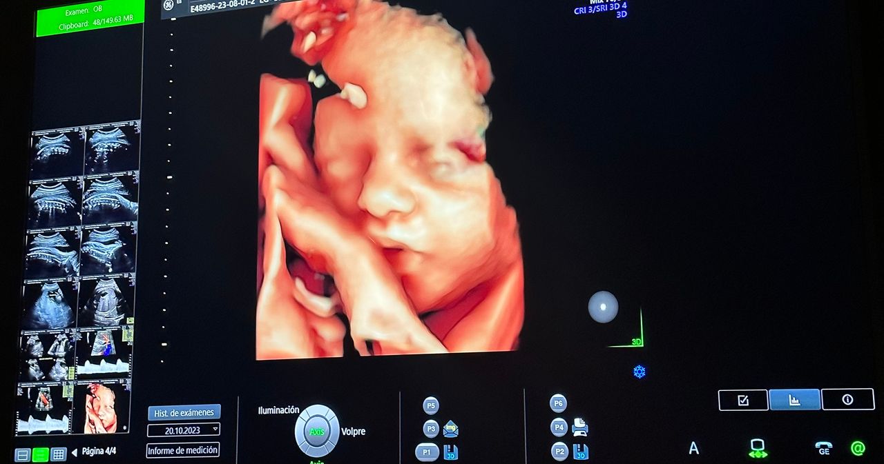 Erika F. Peraza Ortega-3