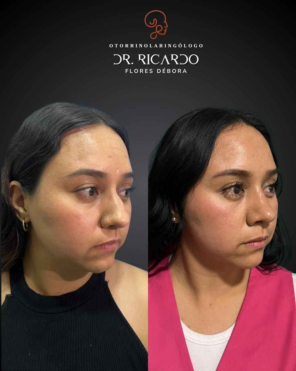 Ricardo Flores Débora-12