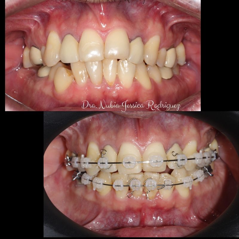 Nubia Jessica Rodríguez  Gutiérrez-22