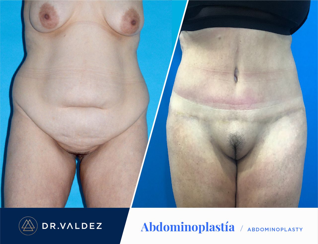 Pedro Arturo Valdez Gomez-26