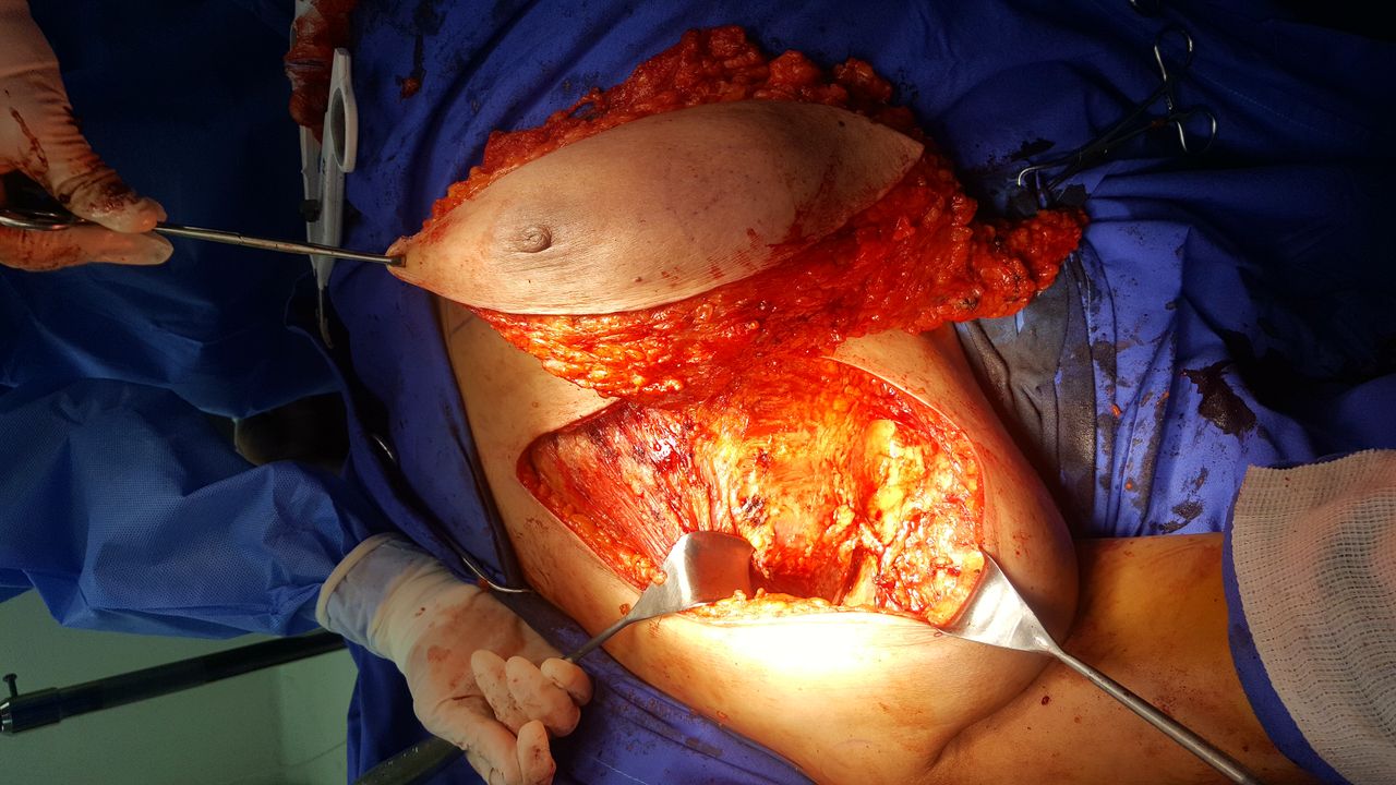 Ángel Millán Juárez-43