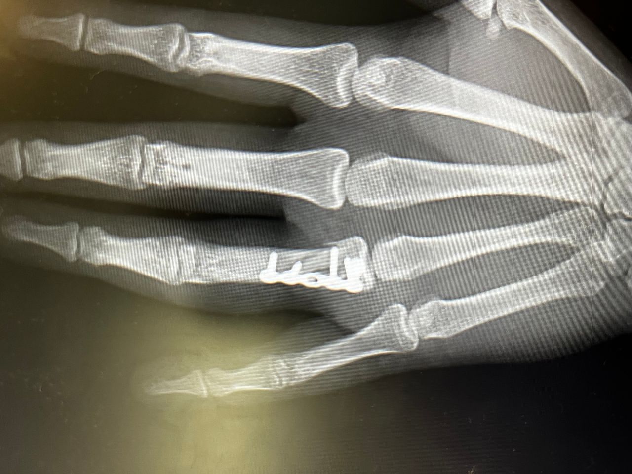 Alberto Lorenzo Cortés-0