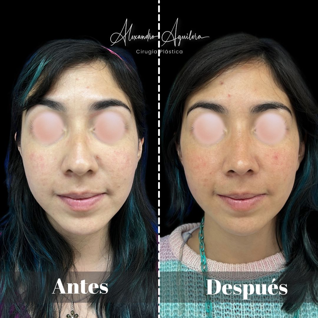 Alexandro Aguilera Salgado-44