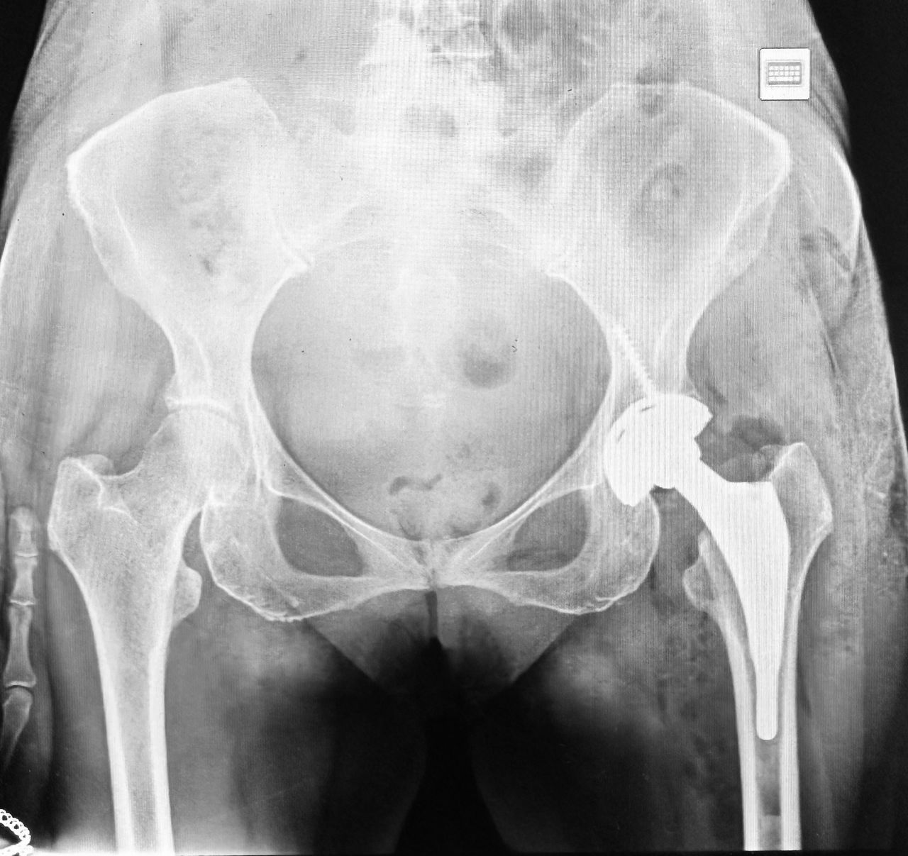 Alejandro Martínez Ramírez-43