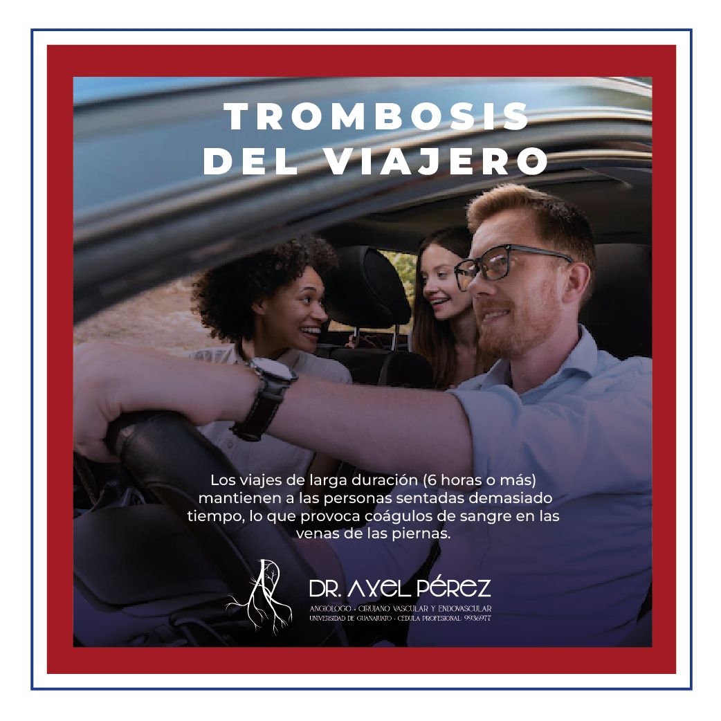 Axel Iván Pérez Flores-1