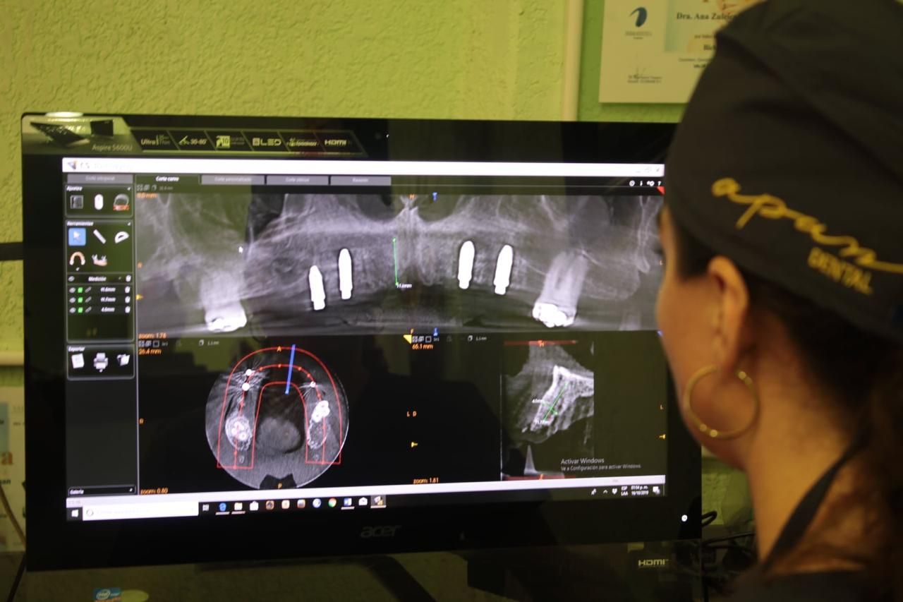 Zuleica Vera Apan-67