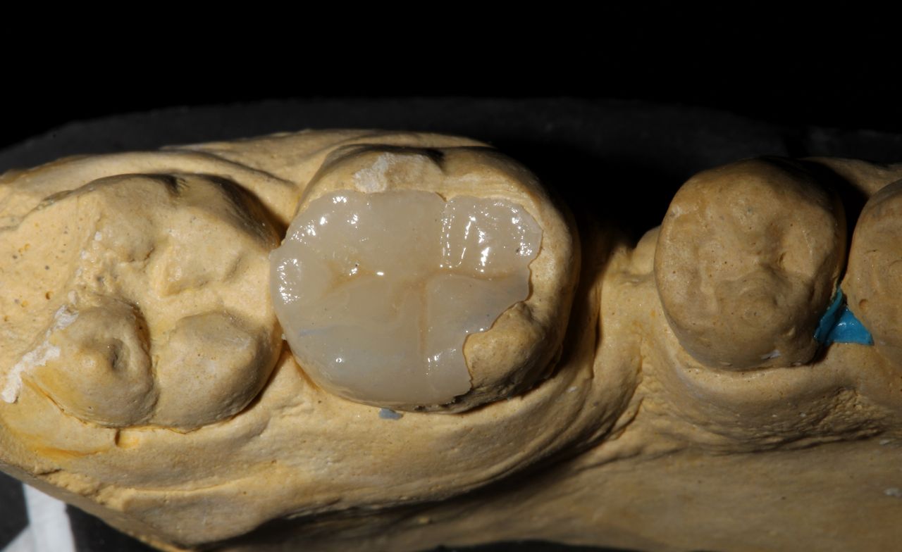 Hylse Najera Moya-23