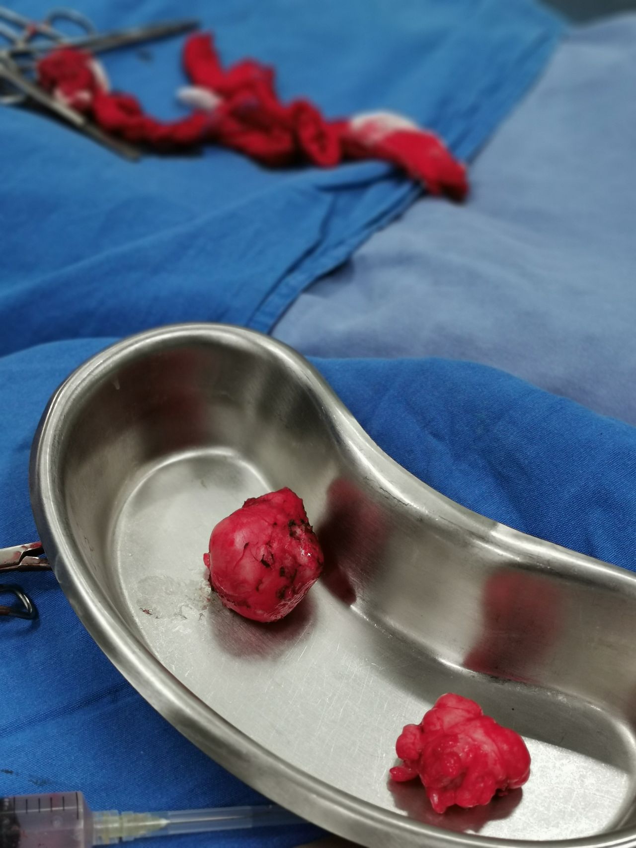 Wilberth Antonio Salazar Ozuna-6