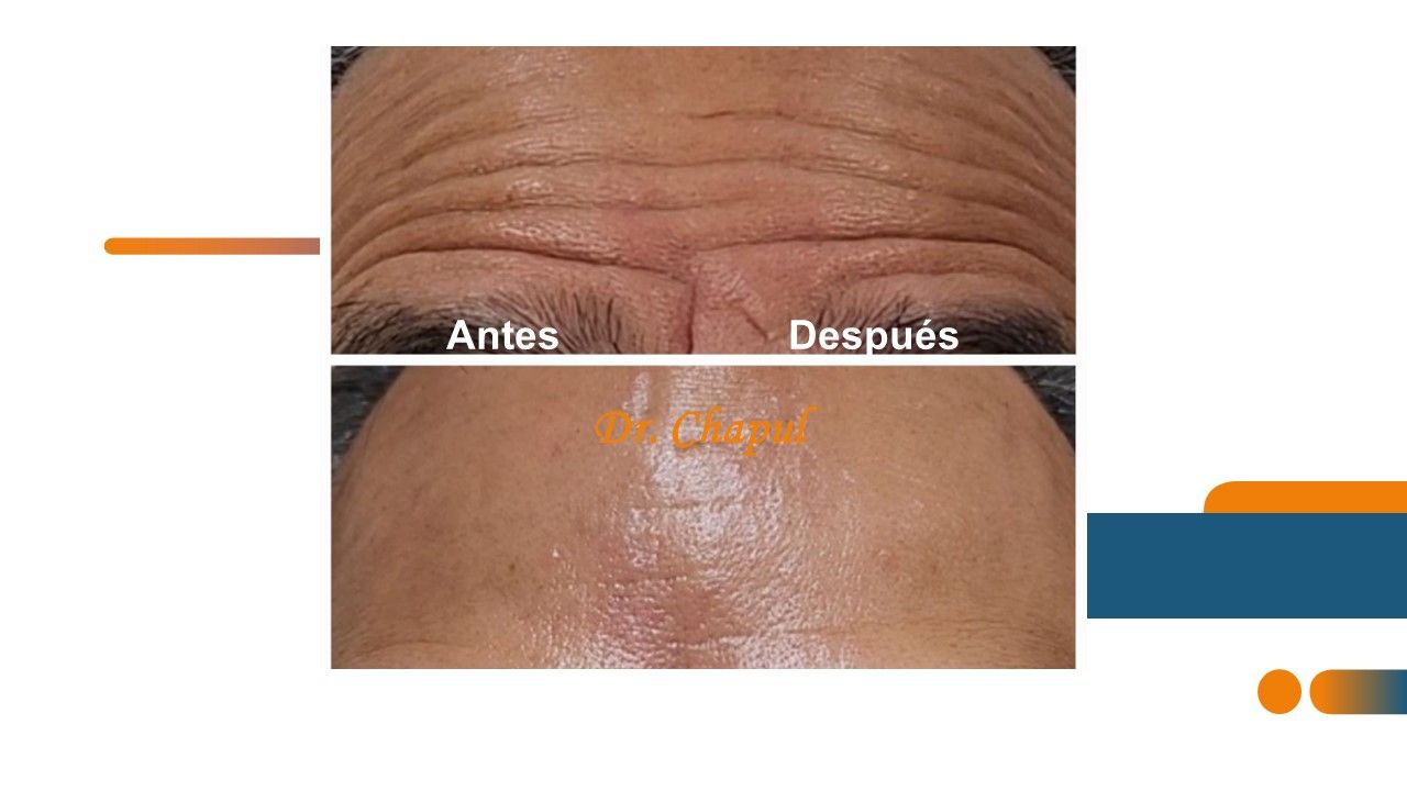 José Luis Muñoz Chapul-26