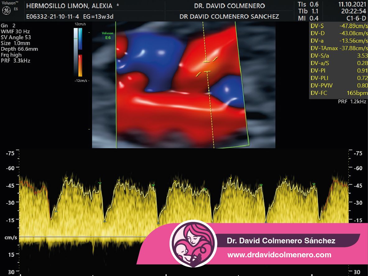 David Colmenero Sánchez-11