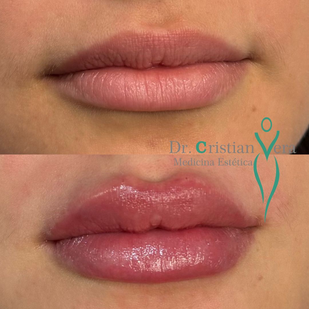 Cristian Eduardo Vera Nuño-7