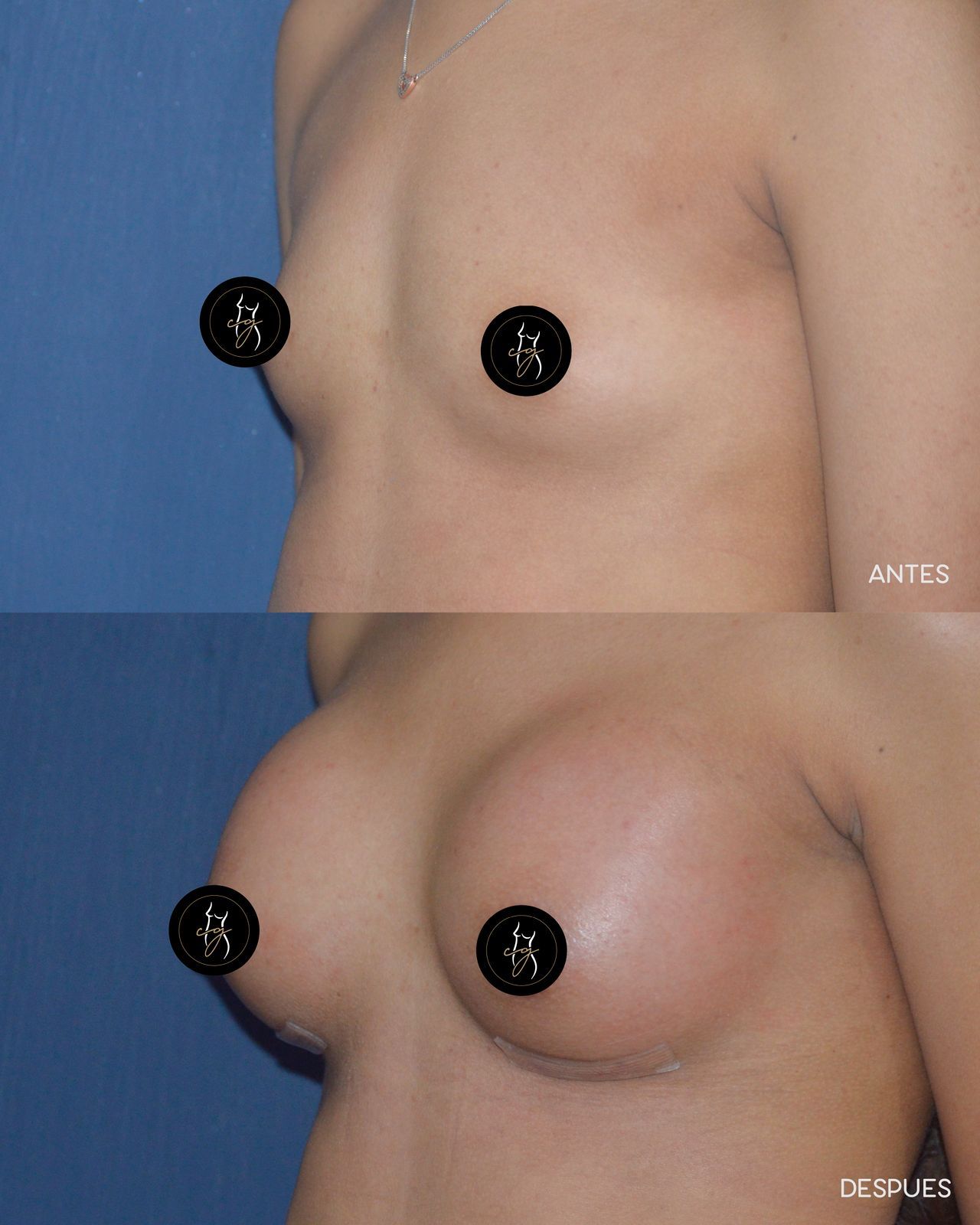 Carlos Alberto Gaitán García-6