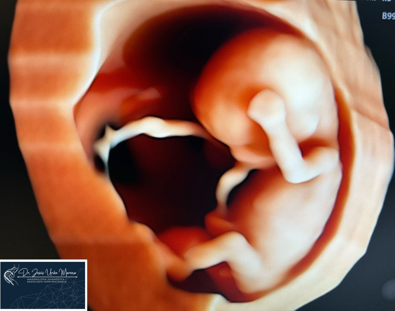 Jesus Uribe Moreno-4